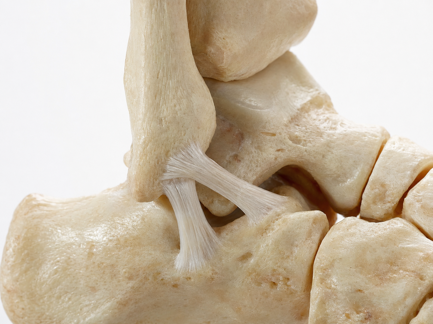 Anatomical model showing the lateral ankle ligaments — ATFL and CFL — connecting the fibula to the talus and calcaneus