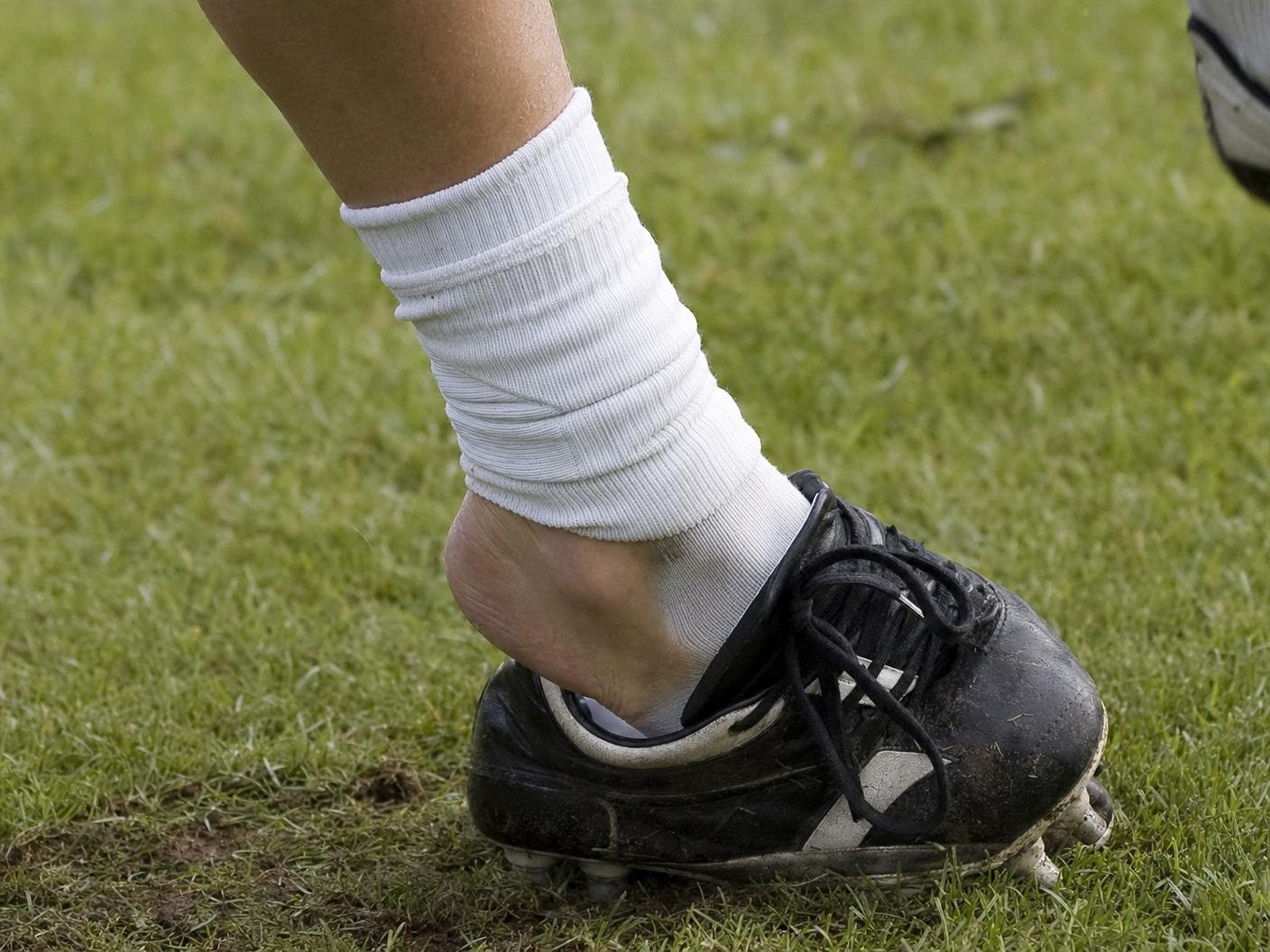 Athlete's foot rolling inward during sport — inversion ankle injury causing lateral ligament damage