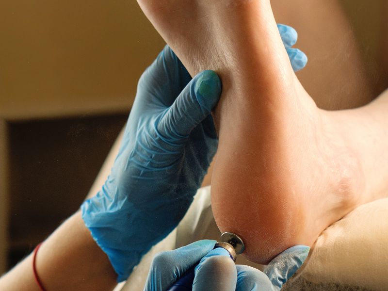 Achilles tendon examination